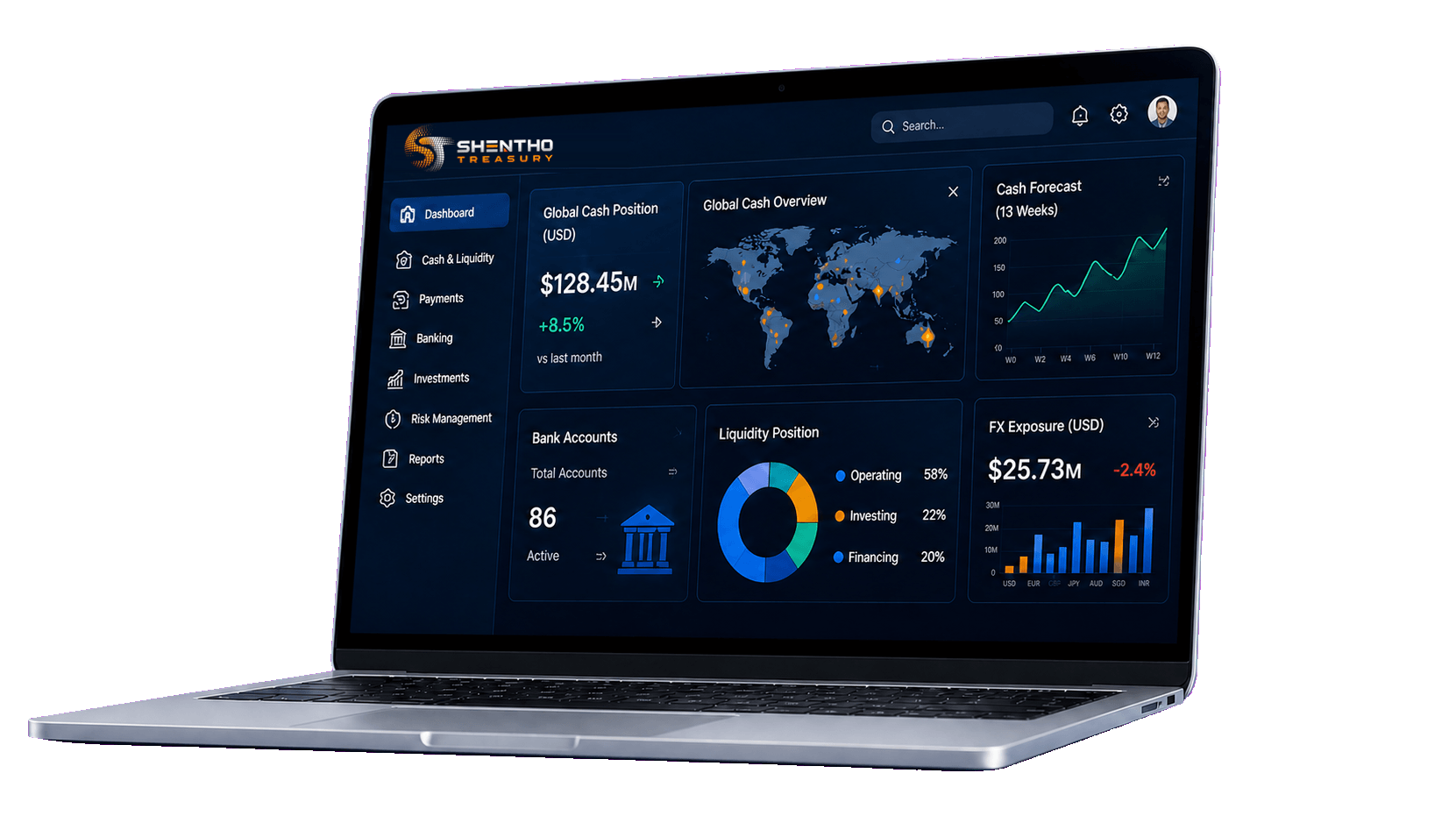 Realistic silver laptop displaying the Shentho Treasury management dashboard
